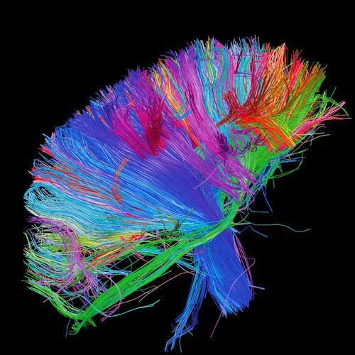 i have synesthesia and this is how it affects me as a v0 The Colour Of Music aka Synesthesia: Inside the Minds That See Sound